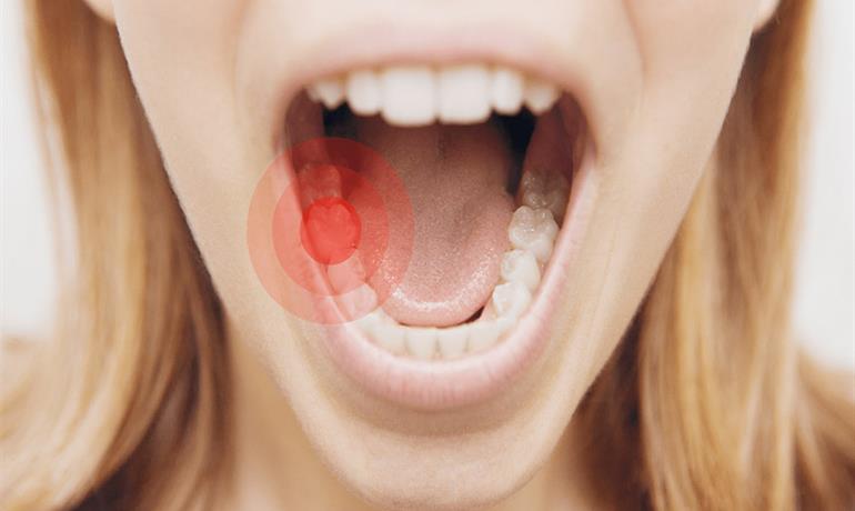 دلیل درد یهویی دندان چیست؟